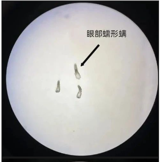 那些紋美瞳線的人 現(xiàn)在都怎么樣了？