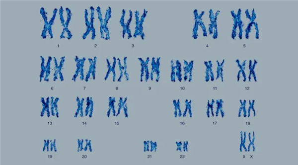 6號(hào)染色體缺失 英國(guó)女孩無(wú)痛覺(jué)、無(wú)饑餓、無(wú)疲勞：全球唯一