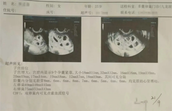 懷9胞胎女子丈夫決定減胎：可能需要多次手術(shù)